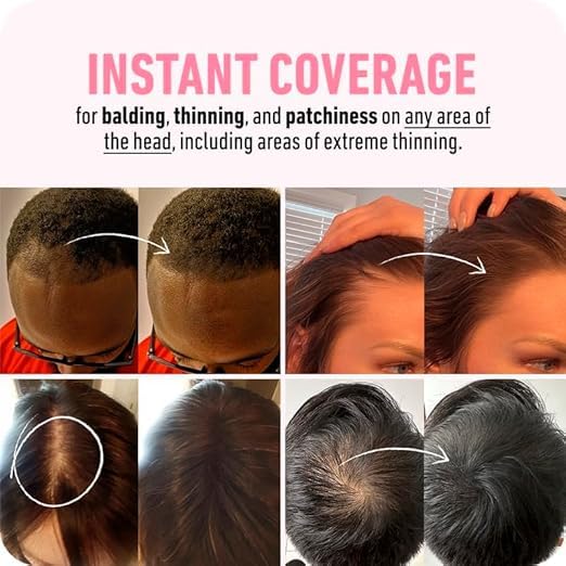 Hairline Root Touch Up Powder – Instant Hair Coverage